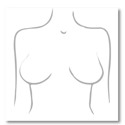 Types of breast  Breast, Warner's, Asymetrical